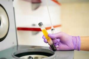 regenerative medicine stem cells, PRP, Amnion treatments west end regenerative medicine washington dc