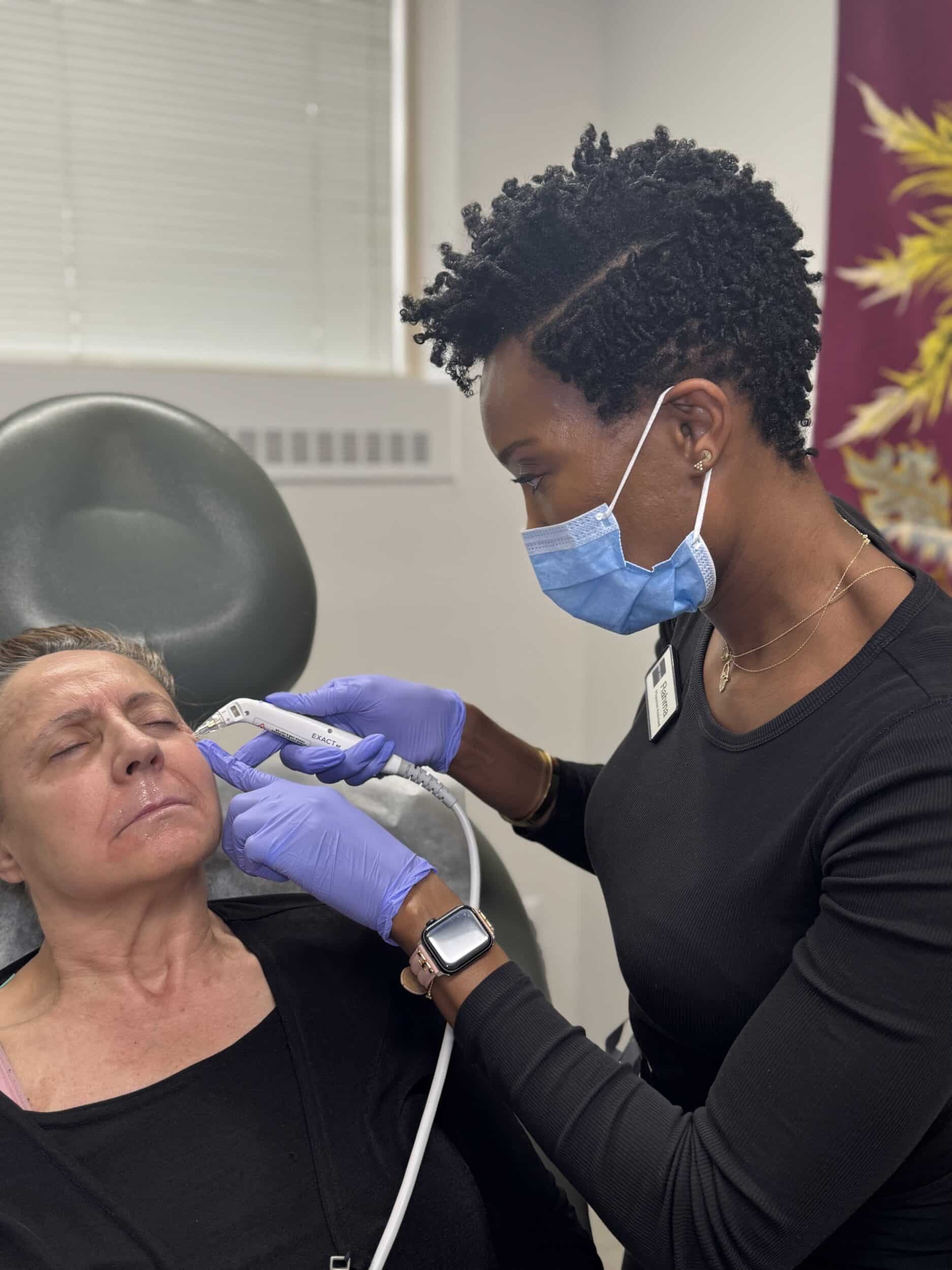 Exact RF Microneedling in Washington, DC
